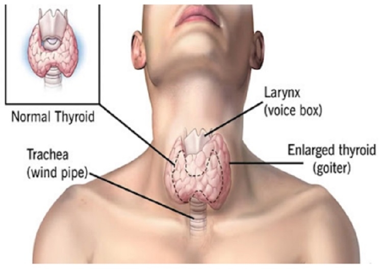 thyroid